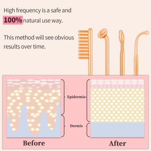 Facial Electrotherapy Wand